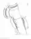 Fig. 34 - Mechanical restraint member