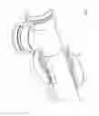 Fig. 35 - Mechanical restraint member