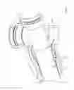Fig. 58 - Mechanical restraint member