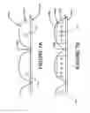 Fig. 10 - Flexible light panel for professional use
