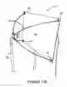 Fig. 17 - Flexible light panel for professional use