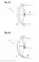 Fig. 03 - Dynamic aircraft headlight and method of operating a dynamic aircraft headlight