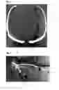 Fig. 03 - Illumination system with magnetic mount for loupes