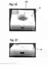 Fig. 08 - Illumination system with magnetic mount for loupes