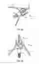 Fig. 11 - Broadhead collars