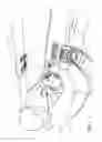 Fig. 02 - Instrument panel assembly with variable length pointer