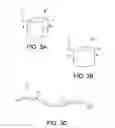 Fig. 04 - Sensing system including a sensing membrane