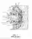 Fig. 02 - Wheel end sensor for heavy-duty vehicles