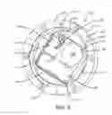 Fig. 04 - Wheel end sensor for heavy-duty vehicles