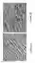 Fig. 05 - System and method for controlling depth of imaging in tissues using fluorescence microscopy under ultraviolet excitation following staining with fluorescing agents
