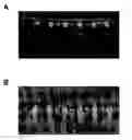 Fig. 01 - THIN-LAYER CHROMATOGRAPHY PLATE, METHOD FOR PRODUCING SUCH A PLATE, AND METHOD FOR PERFORMING A THIN-LAYER CHROMATOGRAPHY SEPARATION