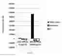 Fig. 11 - Platelet Allo-Antigen Typing And Platelet Antibody Tests