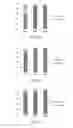 Fig. 03 - Methods for analysis of free and autoantibody-bound biomarkers and associated compositions, devices, and systems