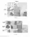 Fig. 08 - Compositions and methods for diagnosing lung cancers