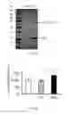 Fig. 10 - Compositions and methods for diagnosing lung cancers