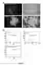 Fig. 03 - Method of isolating circulating tumor cells