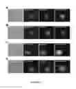 Fig. 12 - Method of isolating circulating tumor cells