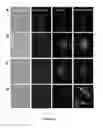 Fig. 13 - Method of isolating circulating tumor cells