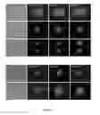 Fig. 15 - Method of isolating circulating tumor cells