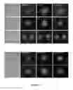 Fig. 16 - Method of isolating circulating tumor cells