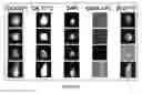 Fig. 20 - Method of isolating circulating tumor cells