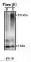 Fig. 03 - Detection of Misfolded Proteins