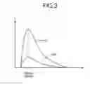 Fig. 04 - Signal processing device and method and radiation detecting device for a pileup phenomenon