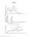 Fig. 06 - Signal processing device and method and radiation detecting device for a pileup phenomenon