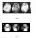 Fig. 06 - METHODS AND APPARATUS FOR ACCURATE CHARACTERIZATION OF SIGNAL COIL RECEIVER SENSITIVITY IN MAGNETIC RESONANCE IMAGING (MRI)