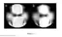 Fig. 07 - METHODS AND APPARATUS FOR ACCURATE CHARACTERIZATION OF SIGNAL COIL RECEIVER SENSITIVITY IN MAGNETIC RESONANCE IMAGING (MRI)
