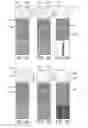 Fig. 05 - Device and method for deblending simultaneous shooting data using annihilation filter