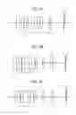 Fig. 04 - Image forming lens and image capturing device