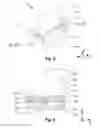 Fig. 04 - Scanner device