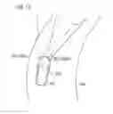 Fig. 11 - LIQUID CRYSTAL LENS, LAMP DEVICE, LIGHTING DEVICE AND LIQUID CRYSTAL LENS DEVICE