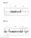 Fig. 08 - Positioning system, a lithographic apparatus and a method for positional control