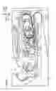 Fig. 02 - Developing unit having guide that stably supports toner cartridge