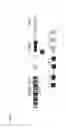 Fig. 09 - FUSION TRANSCRIPT DETECTION METHODS AND FUSION TRANSCRIPTS IDENTIFIED THEREBY