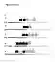 Fig. 46 - FUSION TRANSCRIPT DETECTION METHODS AND FUSION TRANSCRIPTS IDENTIFIED THEREBY