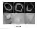Fig. 17 - Apparatus and methods for identifying and evaluating bright spot indications observed through optical coherence tomography