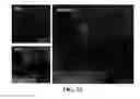Fig. 22 - Apparatus and methods for identifying and evaluating bright spot indications observed through optical coherence tomography