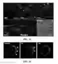 Fig. 24 - Apparatus and methods for identifying and evaluating bright spot indications observed through optical coherence tomography