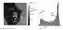Fig. 01 - Method and system for determining a phenotype of a neoplasm in a human or animal body