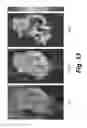 Fig. 14 - Method, system, software and medium for advanced intelligent image analysis and display of medical images and information