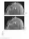Fig. 05 - Method and apparatus for projection image generation from tomographic images