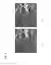 Fig. 06 - Method and apparatus for projection image generation from tomographic images