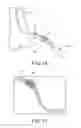 Fig. 11 - Medical image processing apparatus and medical image processing method