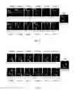 Fig. 06 - Method of constructing 3D image, image processor, and electron microscope