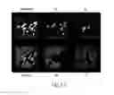Fig. 09 - Method of constructing 3D image, image processor, and electron microscope