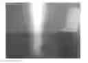 Fig. 01 - Sputtering target and production method of the same