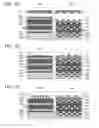 Fig. 03 - WAFER AND METHOD FOR MANUFACTURING MICROSCOPIC STRUCTURE ON WAFER